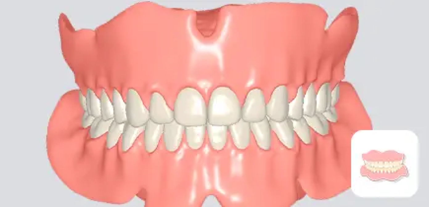 Full Denture